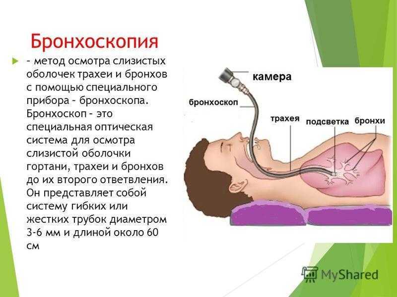 Бронхоскопия. что такое бронхоскопия, показания, противопоказания, виды исследования :: polismed.com