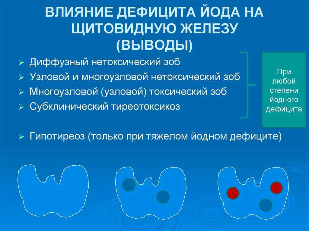 Йододефицит — почему растет зоб | университетская клиника