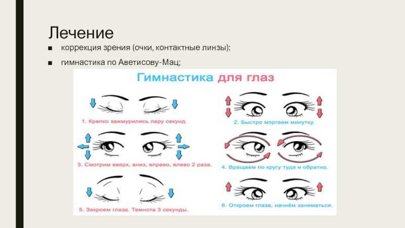 Что лучше – очки или линзы для глаз: советы врачей oculistic.ru
что лучше – очки или линзы для глаз: советы врачей