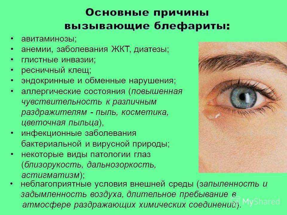 Эпилепсия