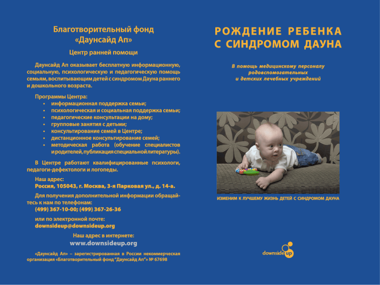 Синдром дауна у плода
