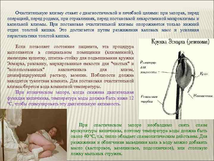 Спринцовки: как правильно пользоваться в домашних условиях | food and health