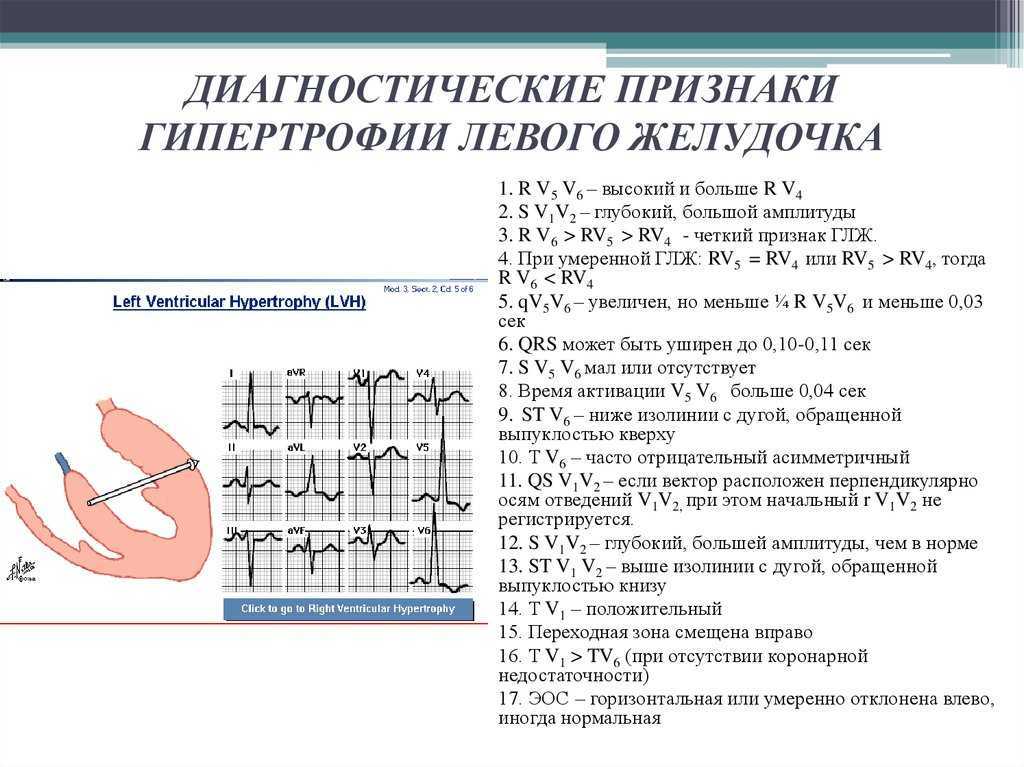 Приобретенные пороки сердца – диагностика и лечение в фнкц фмба россии