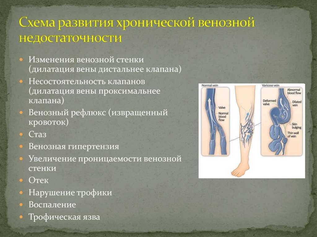 Подкожная мышца шеи: функции платизмы и где она находится