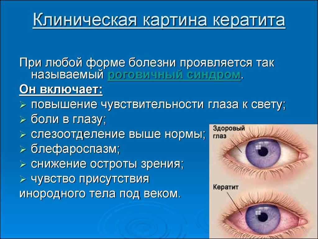 Что делать, если в глаз попала окалина от болгарки?