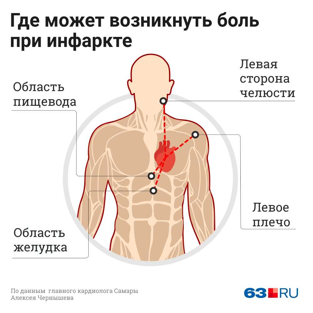 Стенокардия