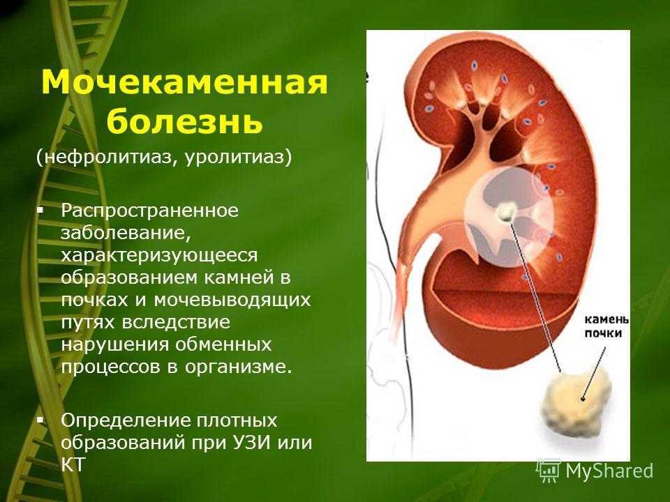 Все, что вам нужно знать об инфекции мочевыводящих путей (имп)