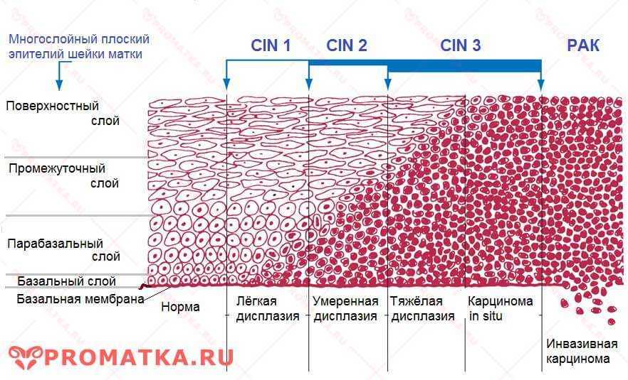 Онкология: что такое рак? понятие онкологического заболевания, причины возникновения злокачесвенных новообразований | клиники «евроонко»