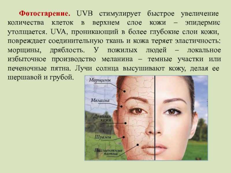 Зачем пользоваться солнцезащитным кремом | food and health