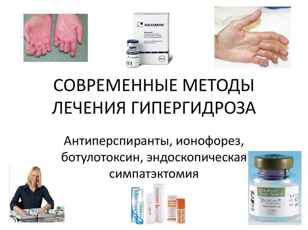 Потеет лобовое стекло: 5 методов борьбы с причинами