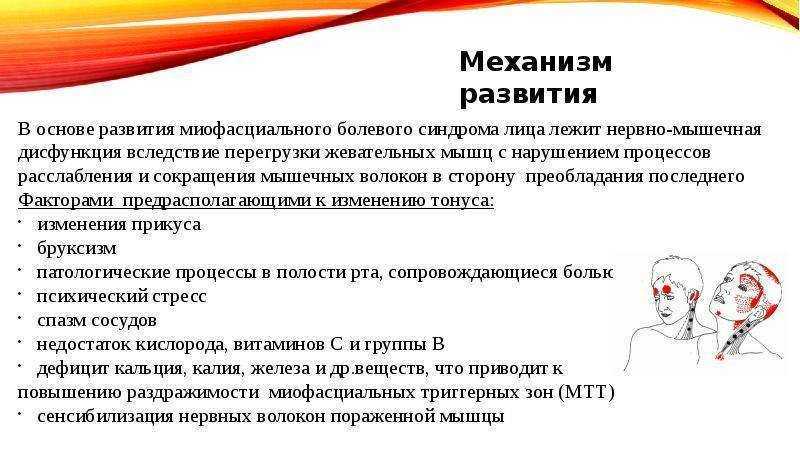 Миофасциальная боль