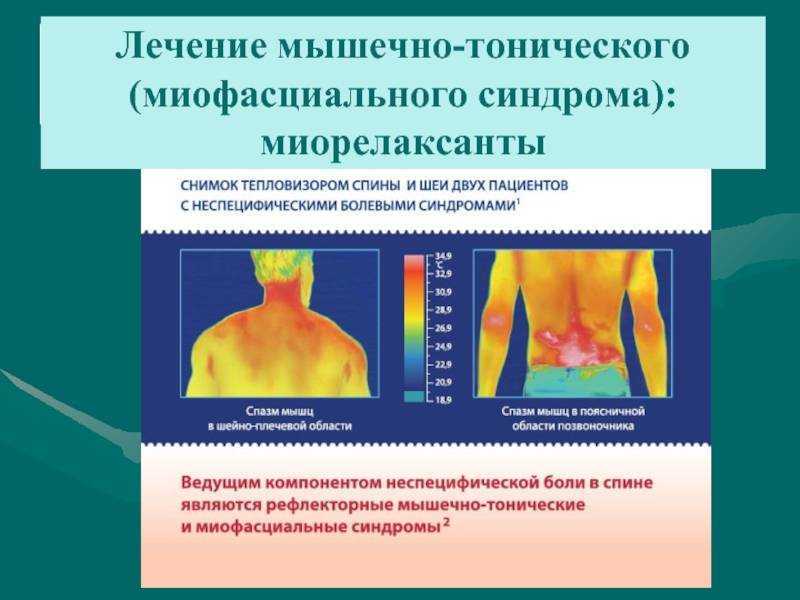 Разрыв мышц. причины, симптомы и лечение!
