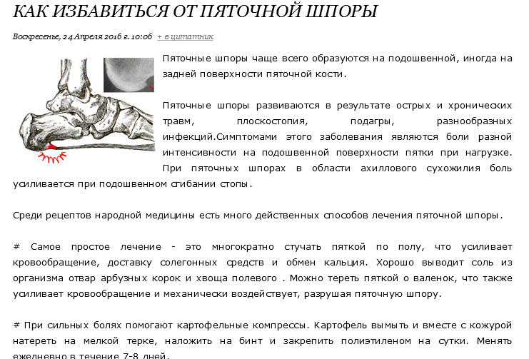 Боль в ногах: причины, симптомы, диагностика и лечение | ким