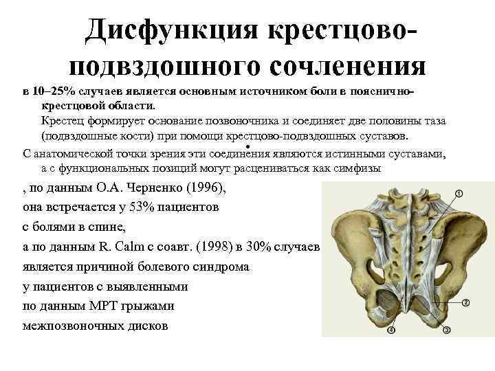 Синдром крестцово-подвздошного сочленения - avicenna klinik