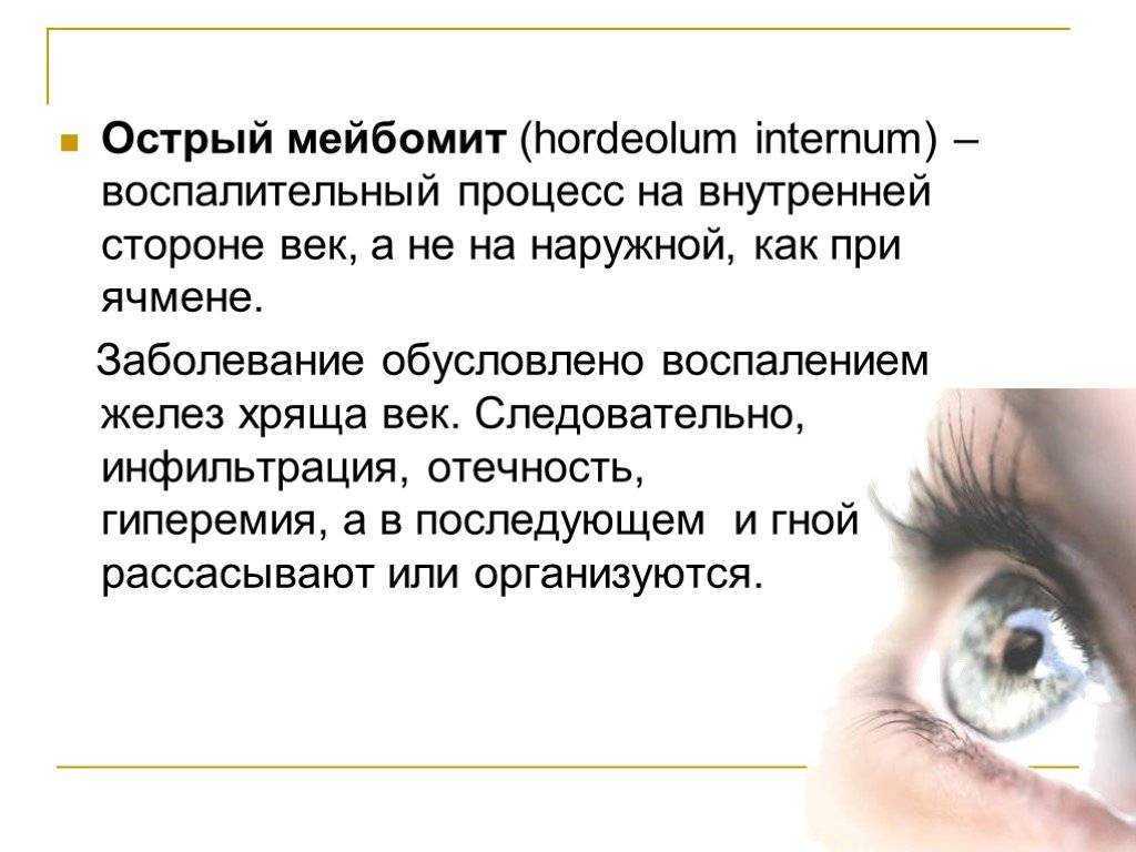 Халазион: симптомы, лечение, причины