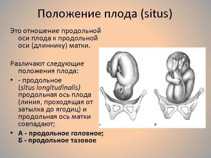 Неправильное предлежание плода