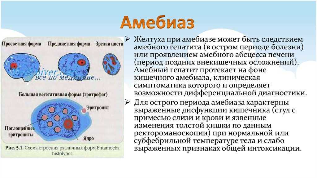 Амебиаз - причины, симптомы, диагностика и лечение патологии