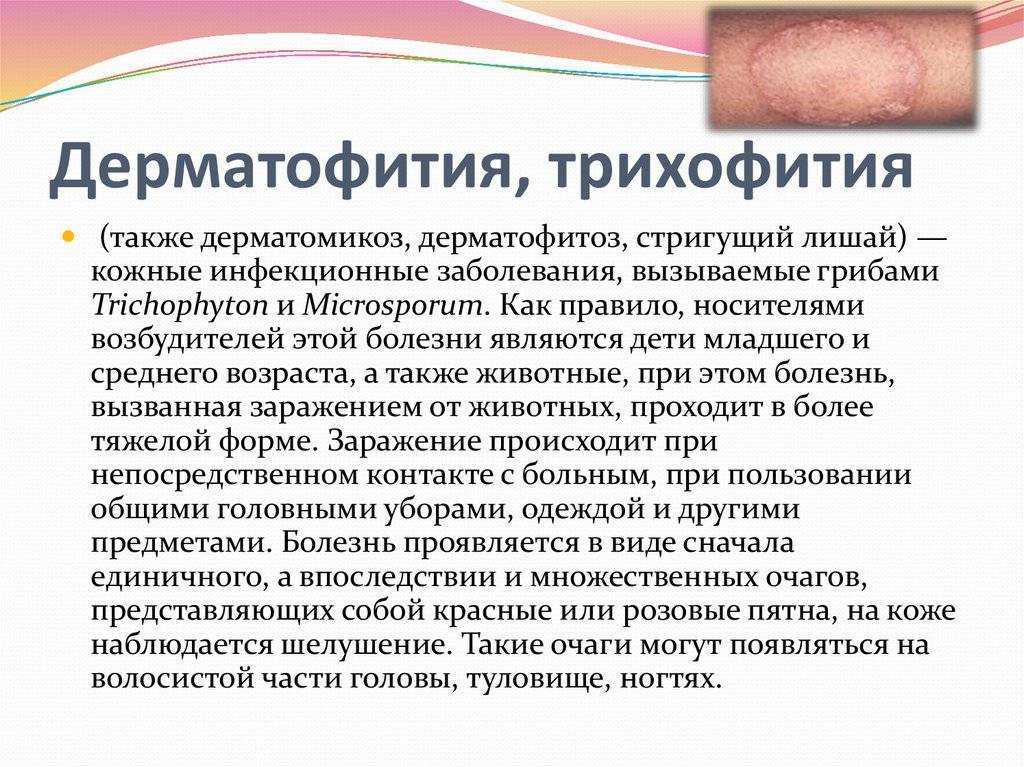 Мозоли на ногах. причины, первая помощь, лечение и профилактика :: polismed.com