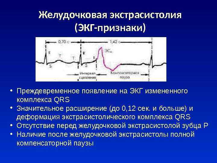 Нарушения ритма (аритмии) и проводимости (блокады) сердца. диагностика и лечениеаритмия сердца. причины, диагностика и лечение сердечной аритмии