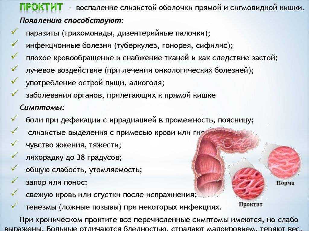 Проктит