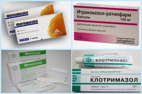 Чем опасны грибковые заболевания и как от них уберечься? - медцентр "диагност"