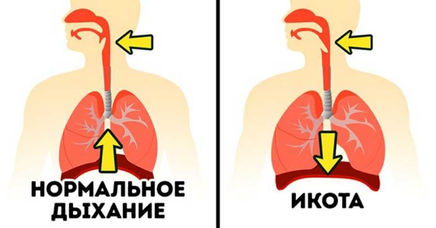 Икота – почему она возникает и как быстро от нее избавиться в домашних условиях? причины икоты у взрослых, у новорожденных после кормления, у беременной женщины и у плода. средства от икоты. как остановить после алкоголя?