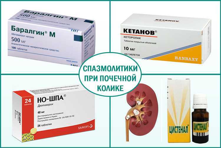 Удаление камней из мочеточника: способы, последствия, осложнения | food and health
