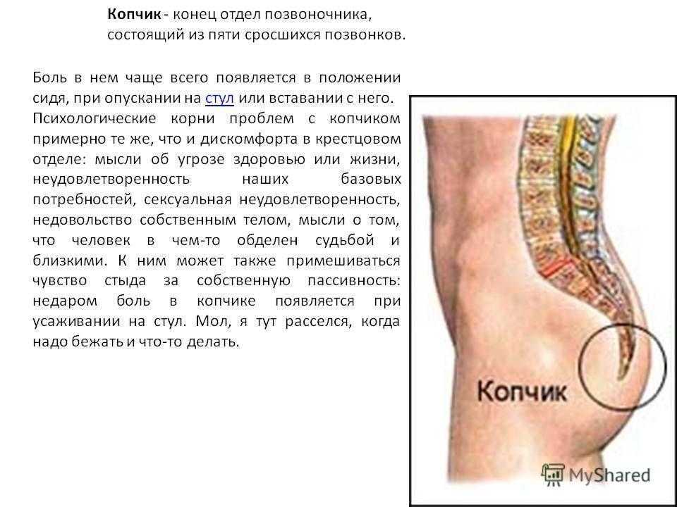 Кокцигодиния или боль в области копчика | kinesiopro