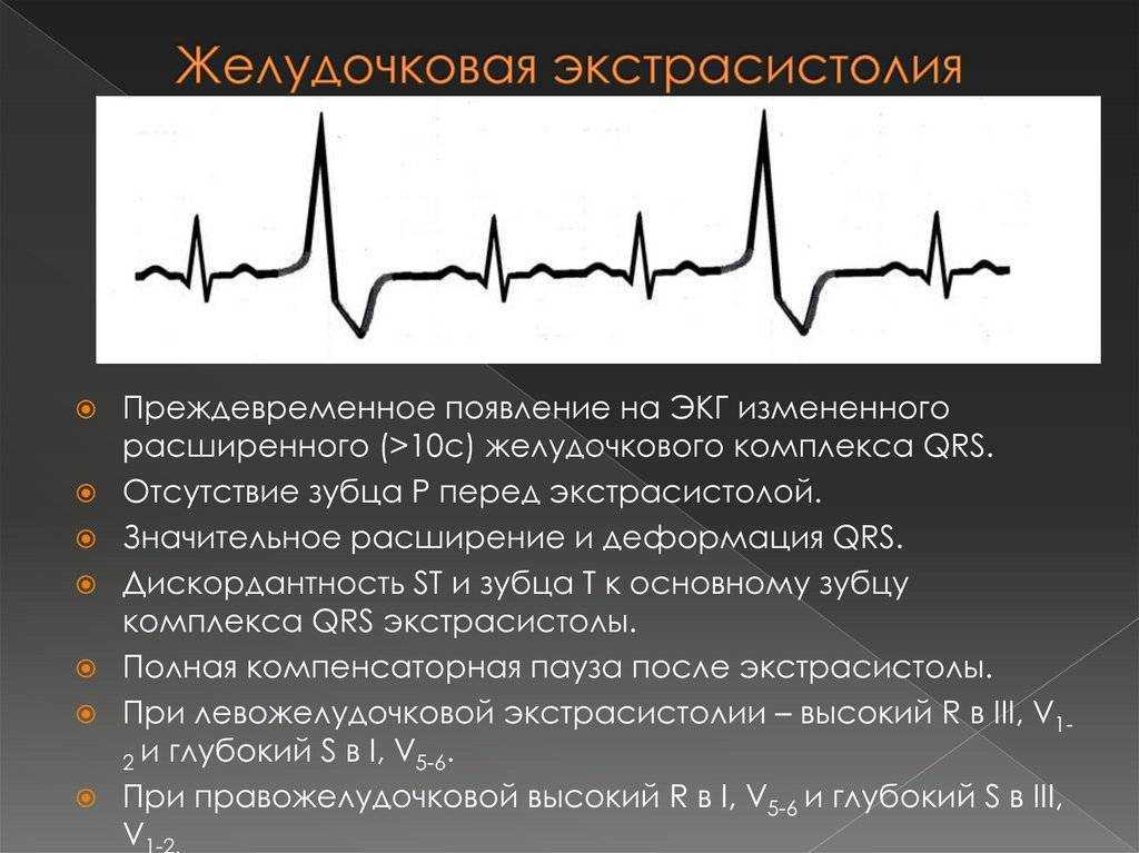 ? гипертрофия левого желудочка: симптомы и диагностика ~?киев?