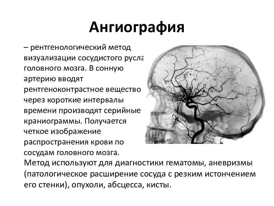 Рентгеноскопическое исследование сосудов, которое проводят после  введения в них рентгеноконтрастных препаратов и позволяет судить о функциональном состоянии сосудов, их расположении, скорости кровотока