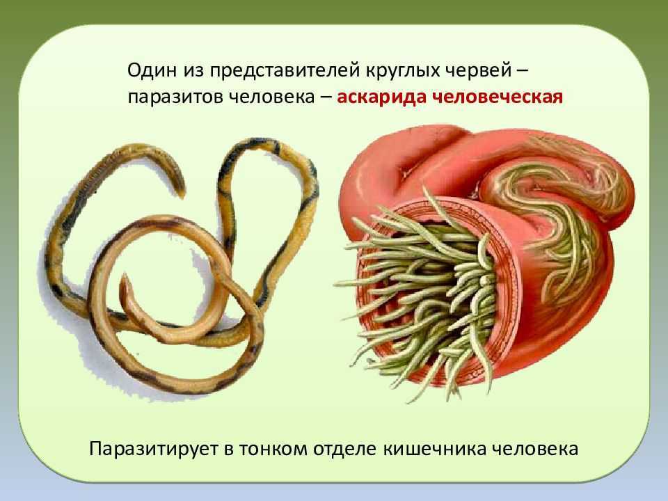 Трихинелла в мясе: как проверить в домашних условиях