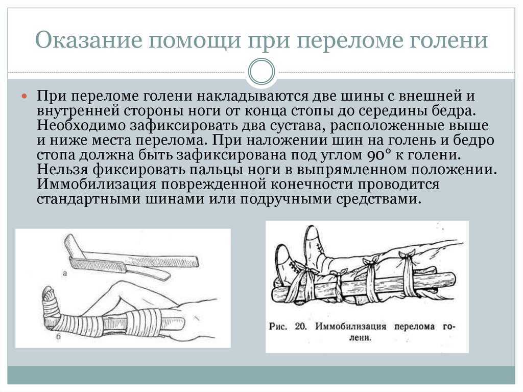 Первая помощь при переломе