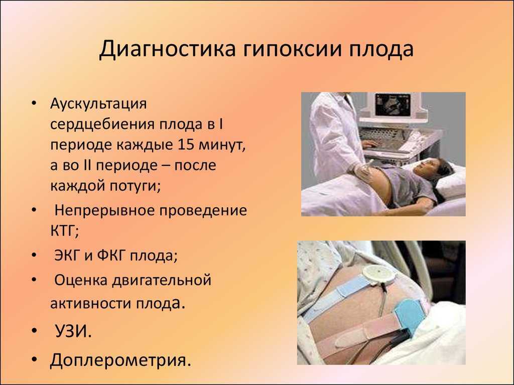 Уреаплазмоз - причины, симптомы, диагностика, лечение, профилактика | университетская клиника