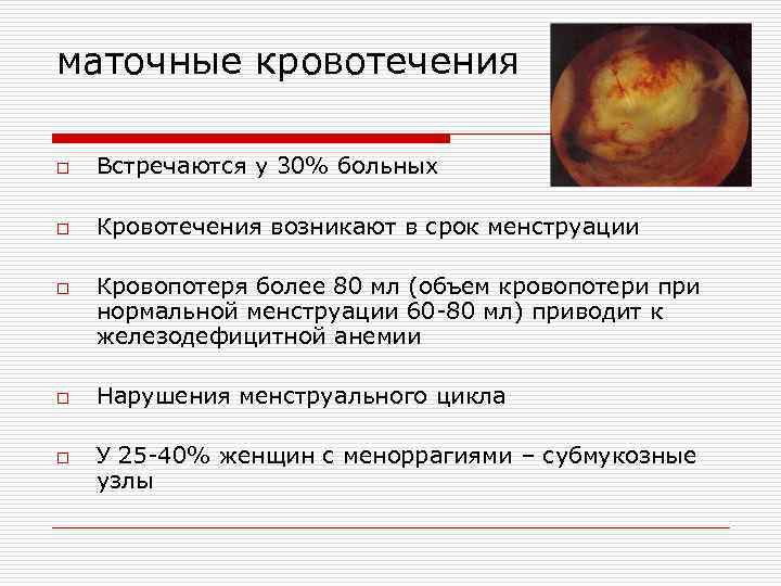 Нерегулярные месячные - медицинский портал eurolab