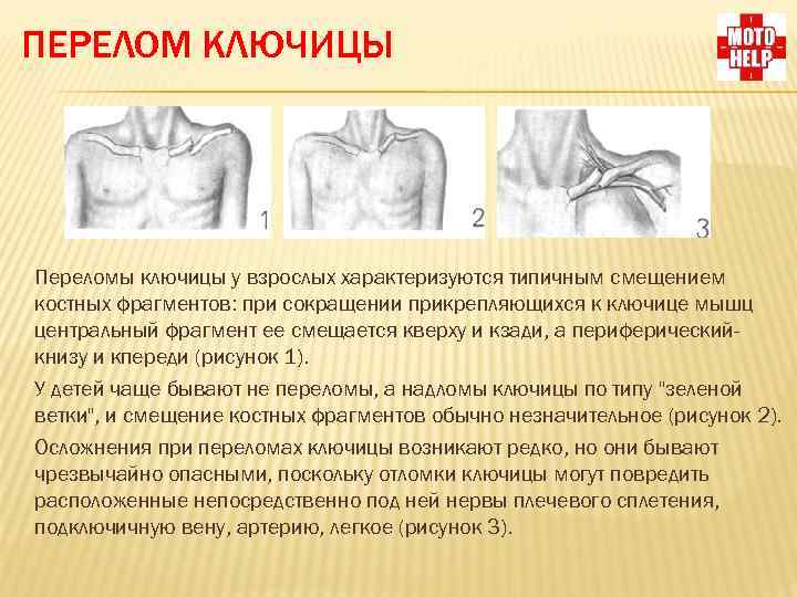 Что такое перелом? типы и признаки перелома.!