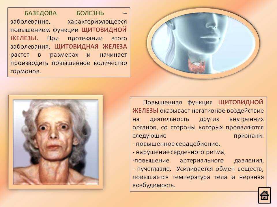Почему в щитовидной железе развивается воспаление? виды тиреоидита