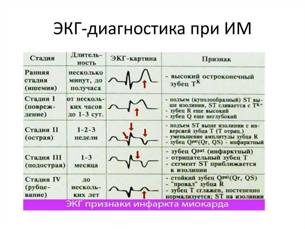 Врождённые и приобретённые пороки сердца