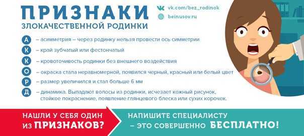 Меланома