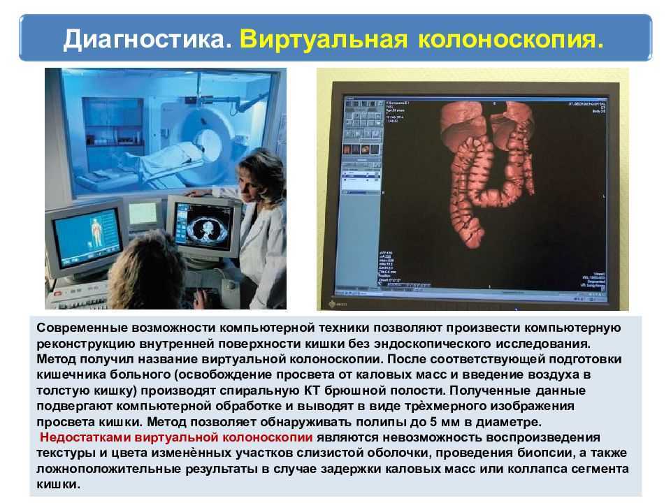Колоноскопия. что такое колоноскопия, показания, какие болезни выявляет