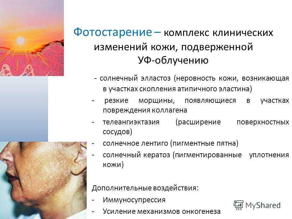 Солярий: особенности, мифы и предрассудки - lovefit.ru