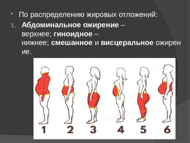 Ожирение